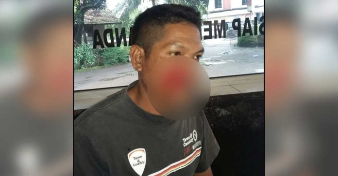 Wajah Pria Asal Lombok Timur Ini Sobek Akibat Diserang Orang Gila