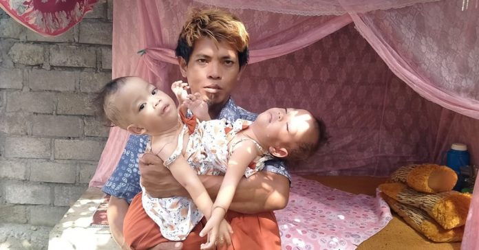 BUTUH DERMAWAN: Bayi kembar siam Inaya-Anaya digendong ayahnya Muhammad Jufri. Operasi pemisahan Inaya-Anaya direncanakan paling cepat awal tahun 2021.( dok/)